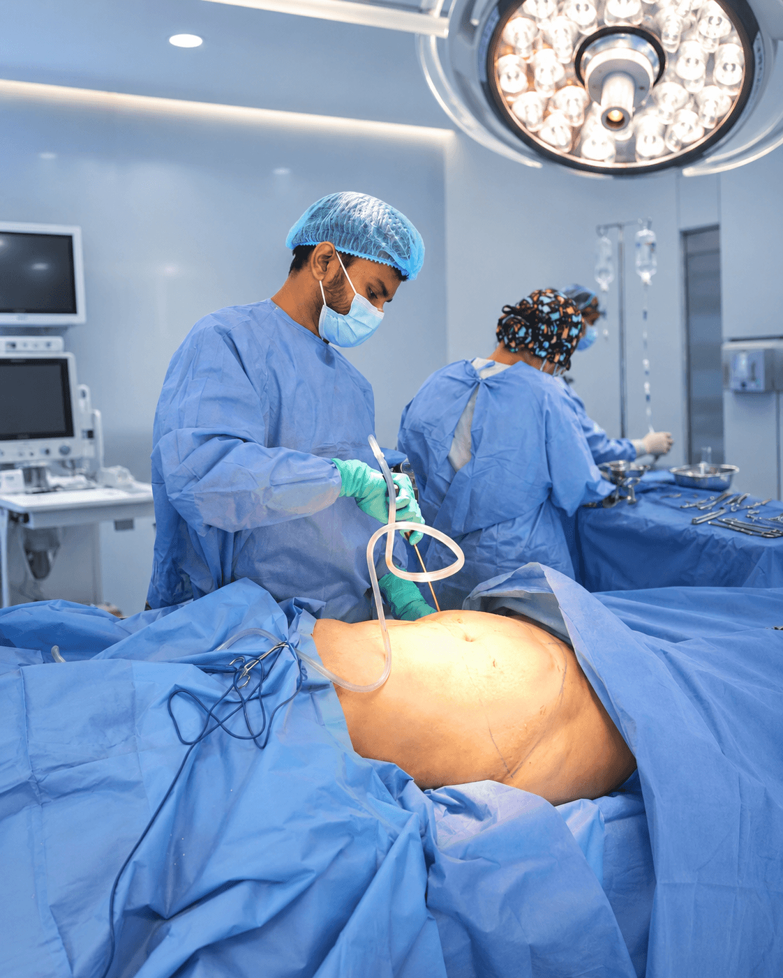 Body Contouring